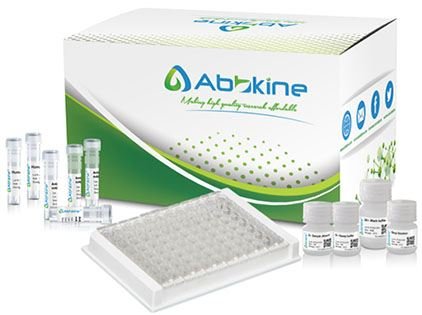 Human Brain-Derived Neurotrophic Factor (BDNF) ELISA Kit