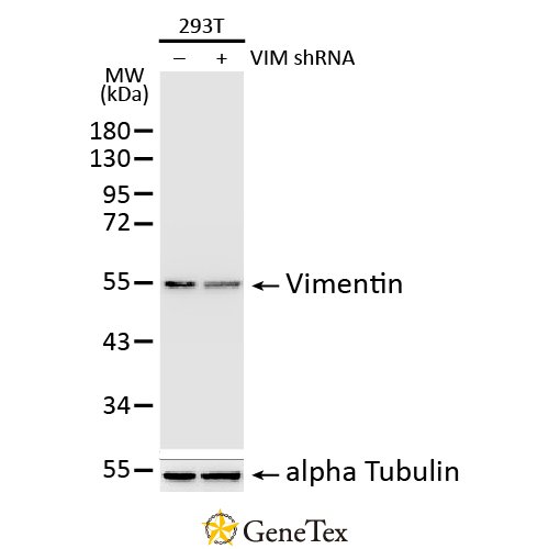 Vimentin Antibody