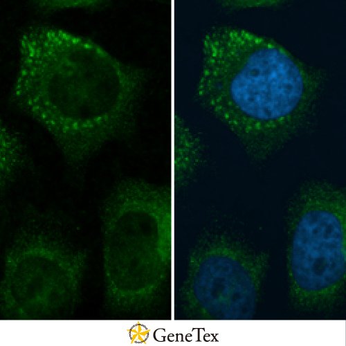 C3 / C3b Antibody [C3], C-term