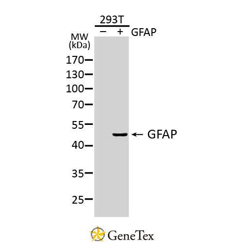 GFAP Antibody