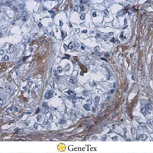 COL1A1 Antibody [N1N2], N-term