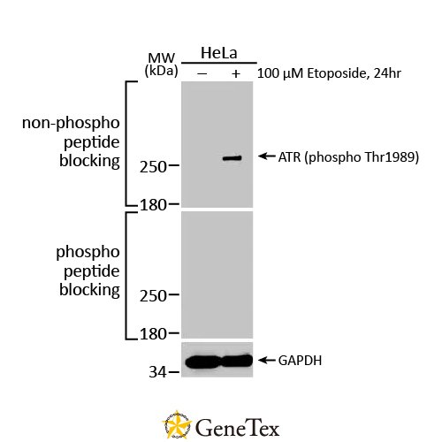 ATR (phospho Thr1989) Antibody [HL132]