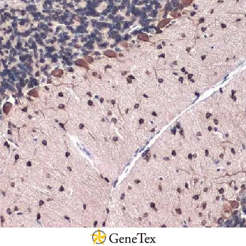 Gli1 Antibody [HL247]