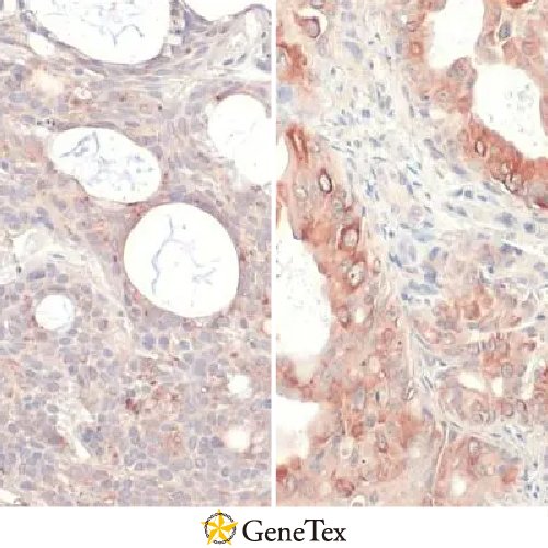 RAS (G12V Mutant) Antibody [HL169]