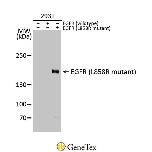 EGFR (L858R Mutant) Antibody [HL1022]