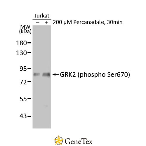 GRK2 (phospho Ser670) Antibody [HL1035]