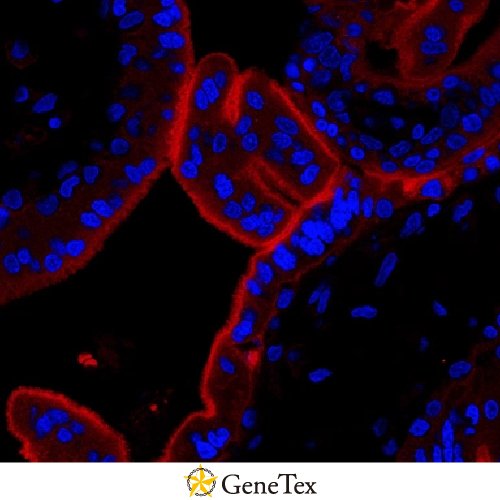 PD-L1 Antibody [HL1041]