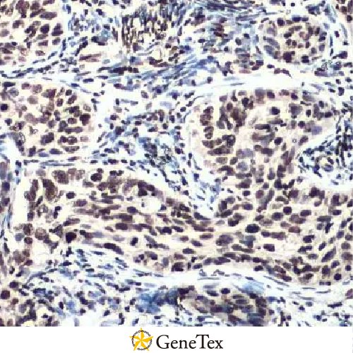 ATM (phospho Ser1981) Antibody [HL1062]