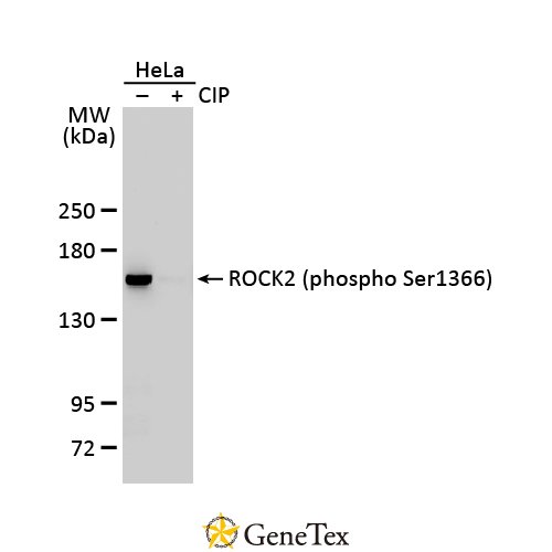 ROCK2 (phospho Ser1366) Antibody [HL1071]