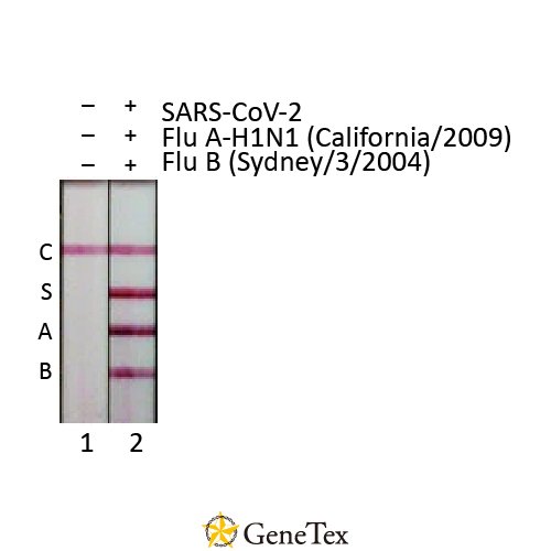 Influenza A Virus Nucleoprotein Antibody [HL1078]