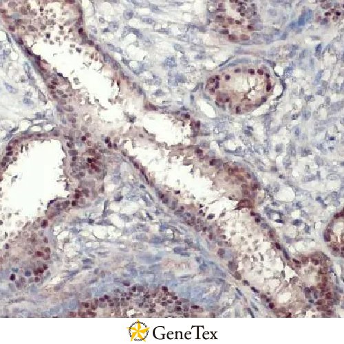 Estrogen Receptor Alpha Antibody [HL1081]