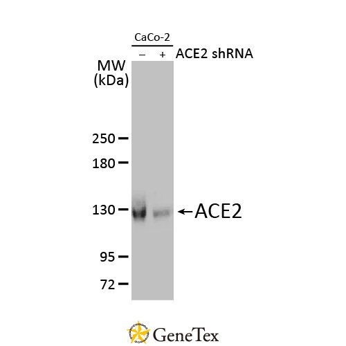 ACE2 Antibody [HL1092]