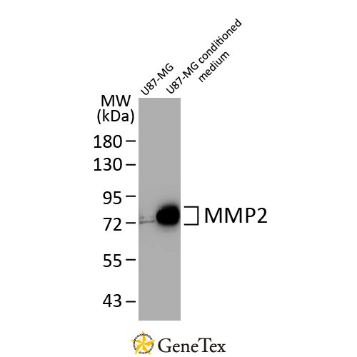 MMP2 Antibody [HL1208]