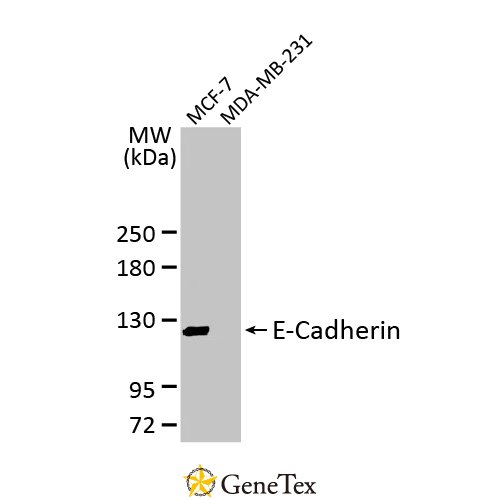 E-Cadherin Antibody [HL1228]