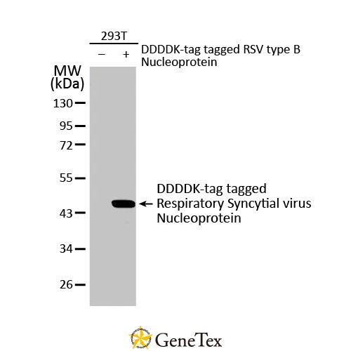 Respiratory Syncytial Virus Nucleoprotein Antibody [HL1245]