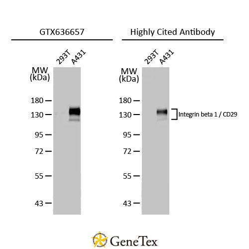 Integrin Beta 1 / CD29 Antibody [HL1255]