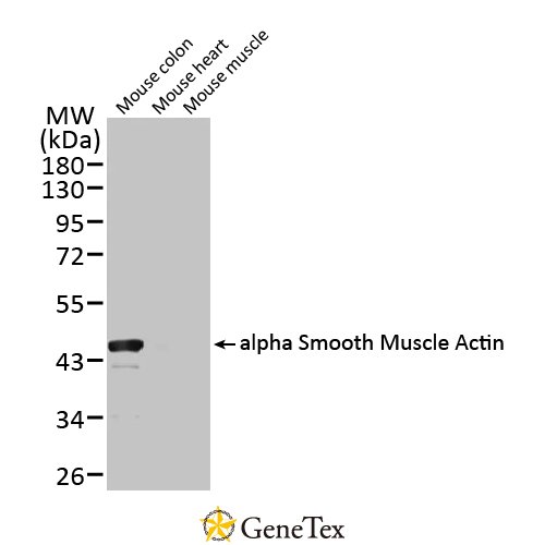 Alpha Smooth Muscle Actin Antibody [HL1419]