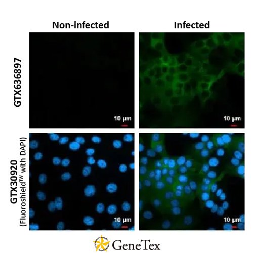 Chikungunya Virus NsP2 Antibody [HL1431]