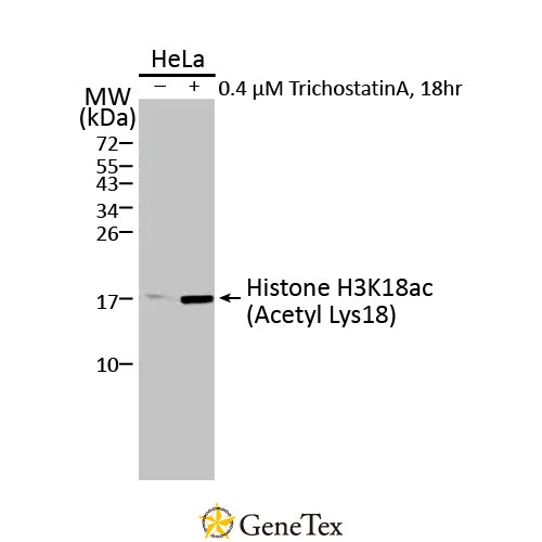 Histone H3K18ac (Acetyl Lys18) Antibody [HL1463]