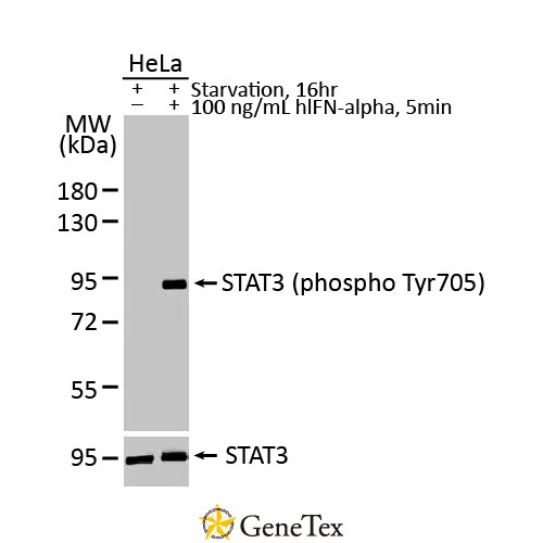 STAT3 (phospho Tyr705) Antibody [HL1464]