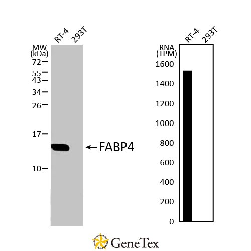 FABP4 Antibody [HL1521]