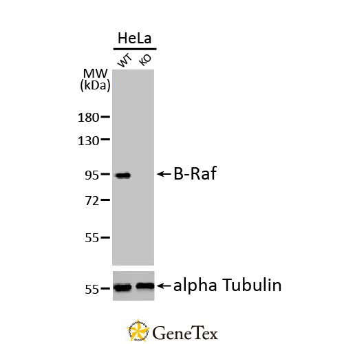 B-Raf Antibody [HL1606]