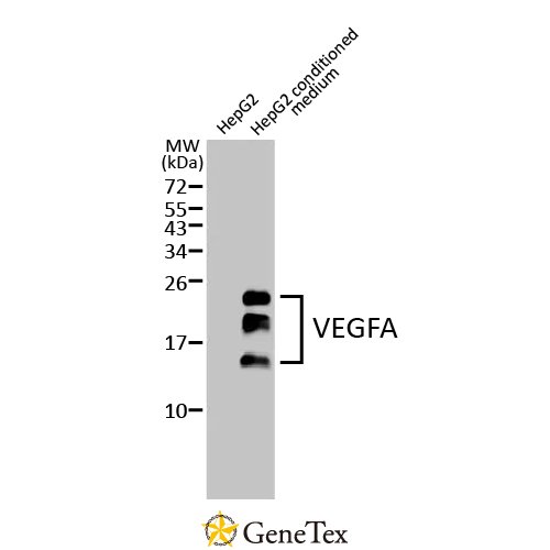 VEGFA Antibody [HL1755]