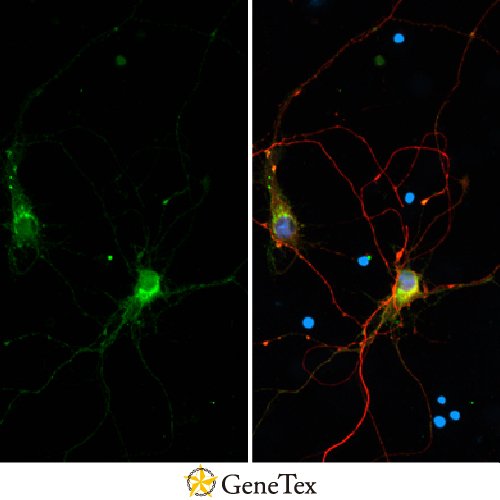 CD90 Antibody [HL1766]