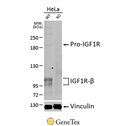 IGF1R Beta Antibody [HL1957]