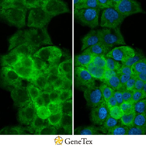 Tryptophanyl TRNA Synthetase Antibody [HL2186]