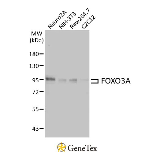 FOXO3A Antibody [HL2190]