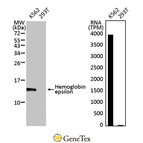 Hemoglobin Epsilon Antibody [HL2457]