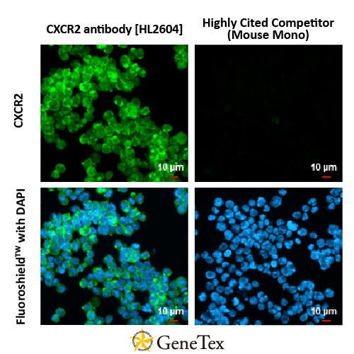 CXCR2 Antibody [HL2604]