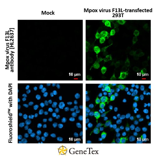 Mpox Virus F13L Antibody [HL2637]