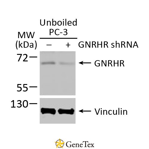 GnRHR Antibody [HL2638]