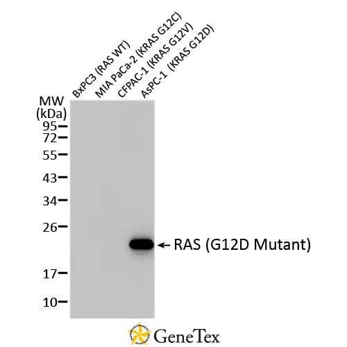 RAS (G12D Mutant) Antibody [HL2640]