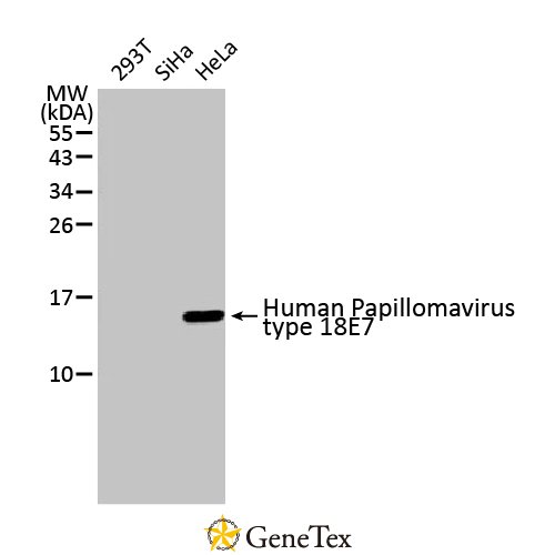 Human Papillomavirus Type 18 E7 Antibody [HL2787]