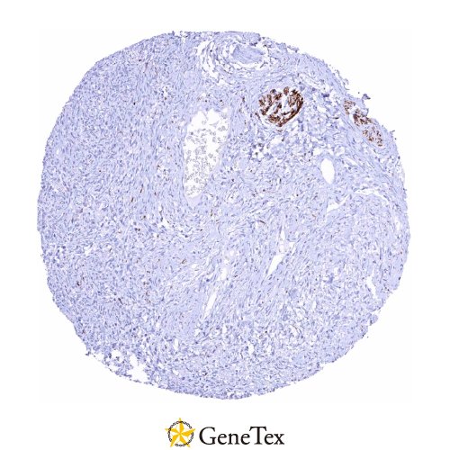 Tyrosine Hydroxylase Antibody [HMV312] HistoMAX™