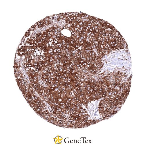 MX1 Antibody [HMV316] HistoMAX™