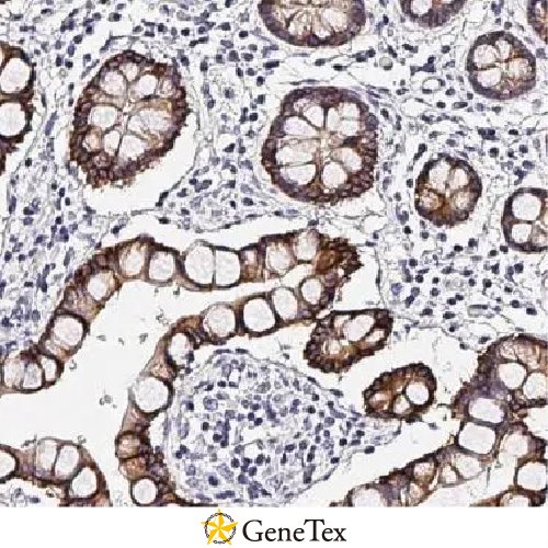 Cytokeratin 19 Antibody [HL2878]